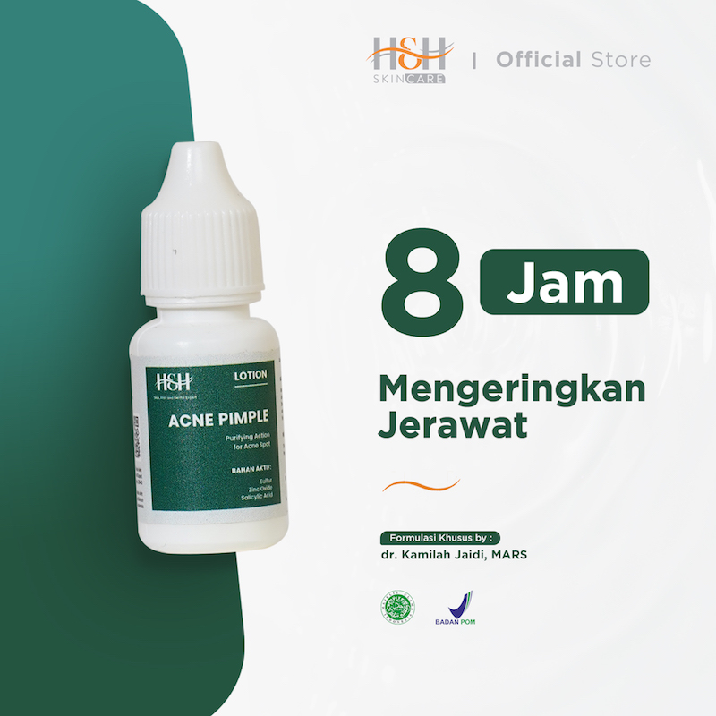 acne pimple lotion obat totol jerawat